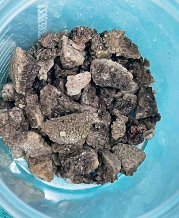 Malatya’da 8 cm’lik Geyik Boynuzu Taşı Çıkarıldı!