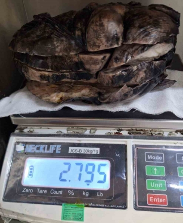 3 Kilogramlık Tümör Başarıyla Çıkarıldı!