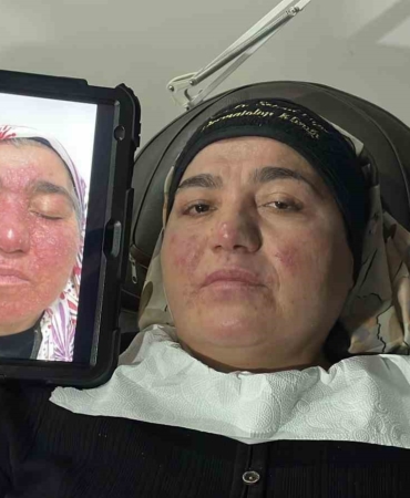 20 Yıl Sonra Özgüvene Kavuşan Neriman’ın Hikayesi